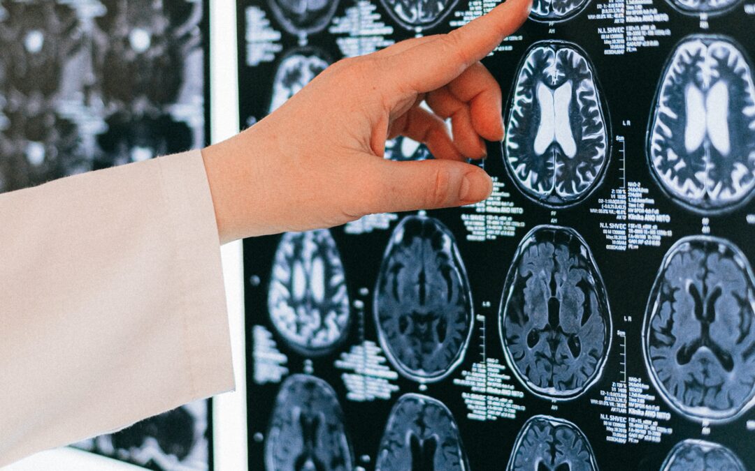 Tips on Concussion Prevention