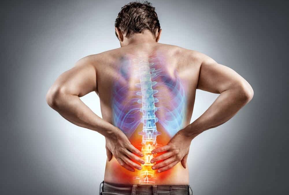5 Common Questions About Lower Back Pain
