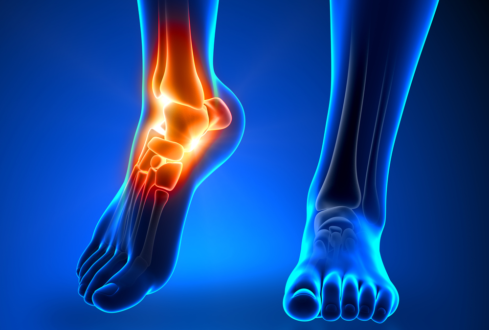 Foot and Ankle Injuries