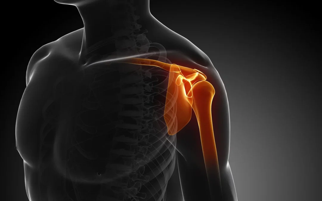 Taking The “Ouch” Out of Shoulder Impingement