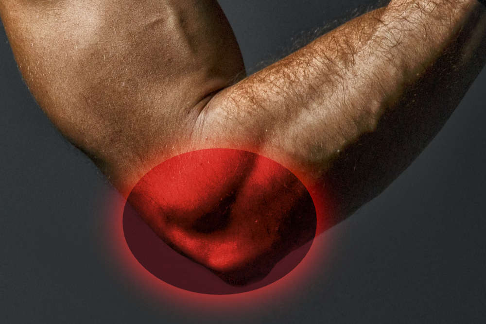 Tennis Elbow Procedure & Treatment Options